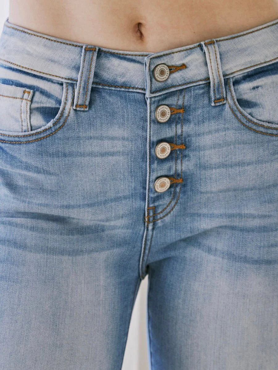 Kitson Button Fly Skinny Jeans