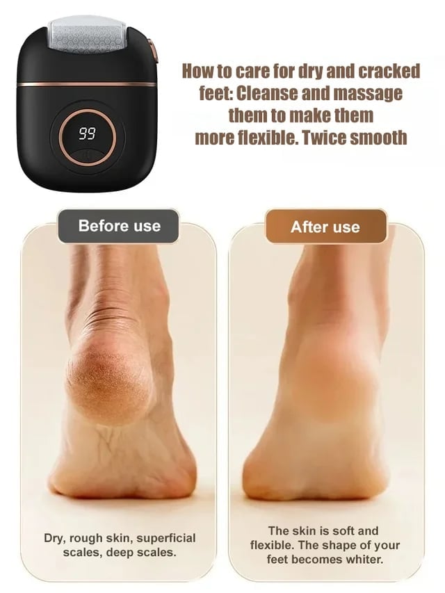 2025 New digital electric foot polishing machine