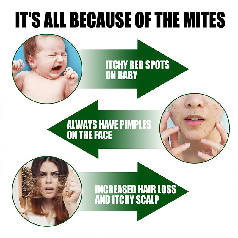 🔥Limited Sale🔥 Powerful Mite Remover Spray