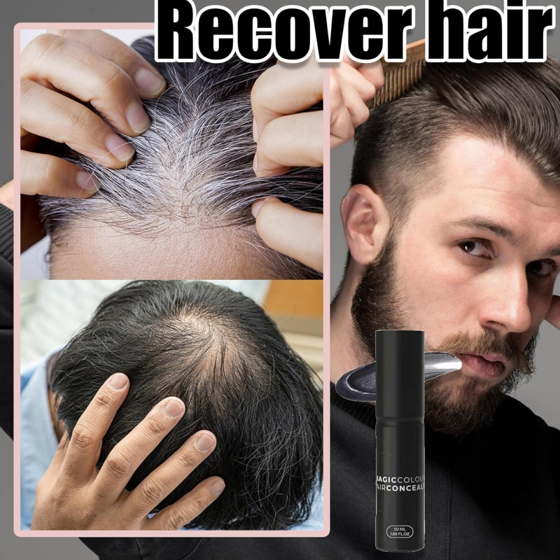 Scalp Concealer for Fuller, Natural-Looking Hair